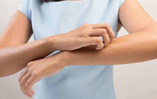 Home Remedies For Treatment Of Scabies