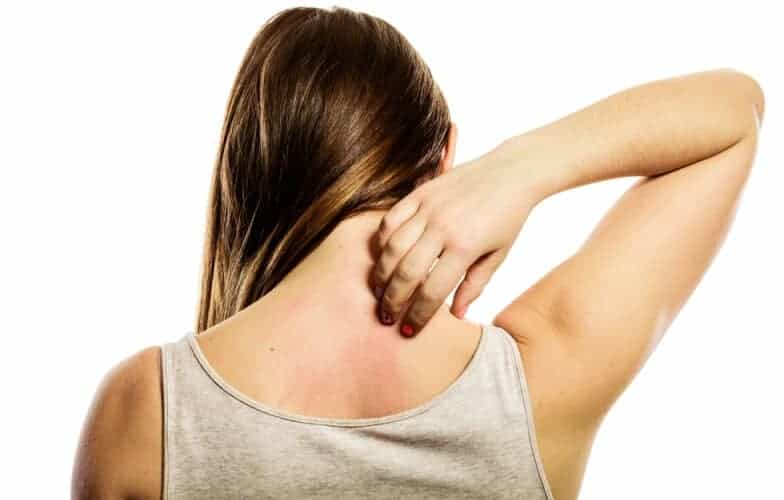 Effective Home Remedies To Get Rid Of Scabies Fast