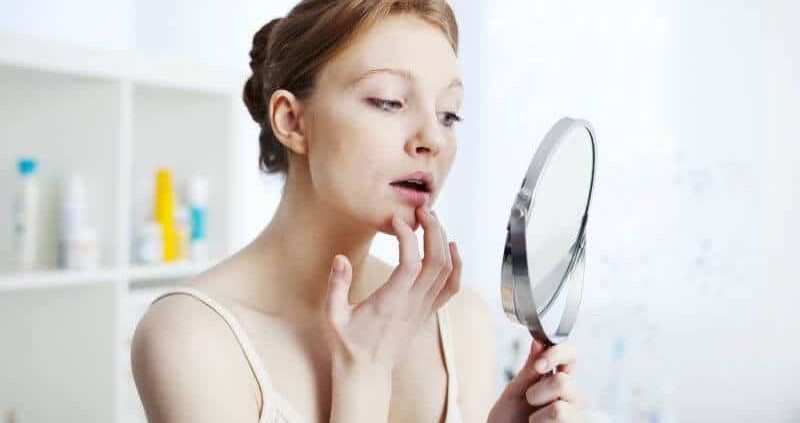 How To Get Rid Of Pimple On Lip Naturally