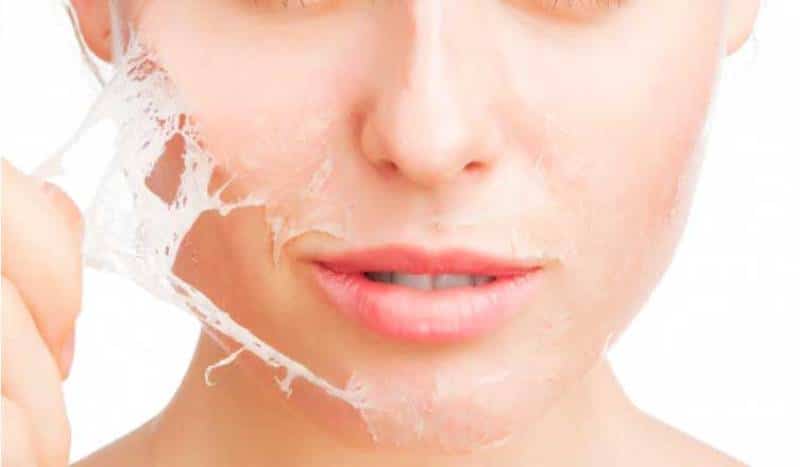 How To Get Rid Of Peeling Skin On Face 