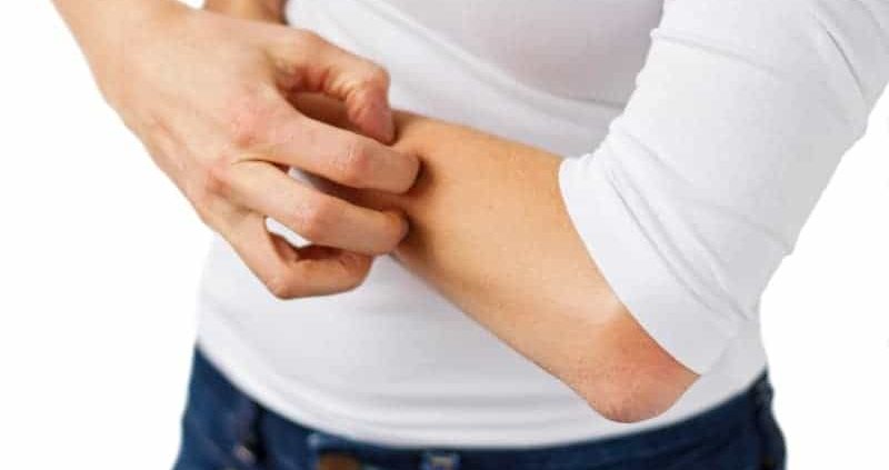 Shingles Without Rash : Symptoms,Causes,Home Remedies &Prevention