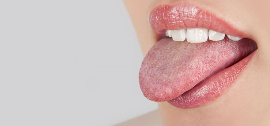 How To Get Rid Of Swollen Taste Buds