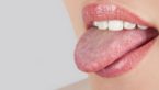 Red Spots On Tongue : Causes ,Symptoms & Home Remedies