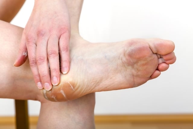 Symptoms of cracked heels