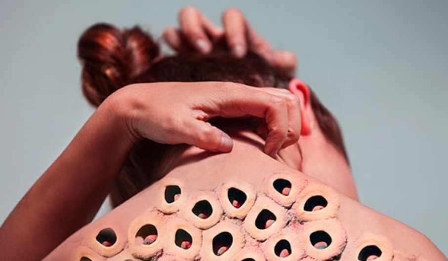 Trypophobia Fear Of Holes On Skin Is This Really Exists