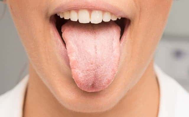 What Are Different Types Of Swollen Taste Buds