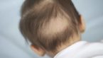 Home Remedies For Hair Loss In Children