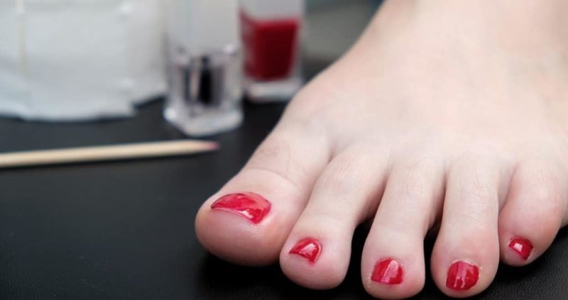 How To Get Rid Of Bruised Toenail Fast With Home Remedies?