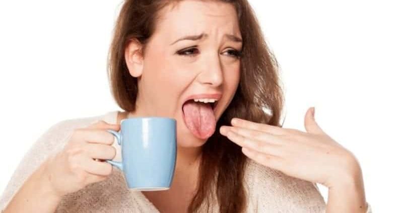 Home Remedies For Tongue Burn That Works