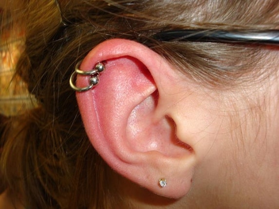 Cartilage piercing infection