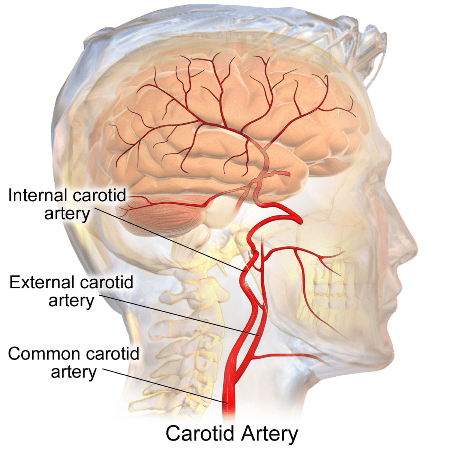 Cartoid artery