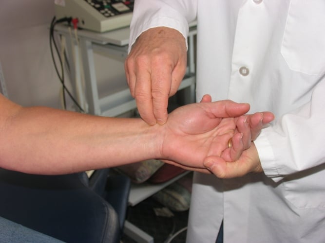how do doctors diagnose carpal tunnel syndrome