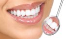 Gingival Hyperplasia : Causes,Symptoms & Home Remedies