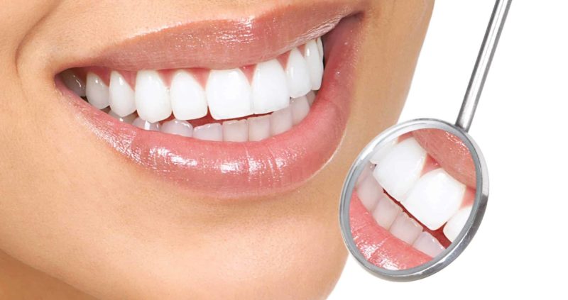 Gingival Hyperplasia : Causes,Symptoms & Home Remedies