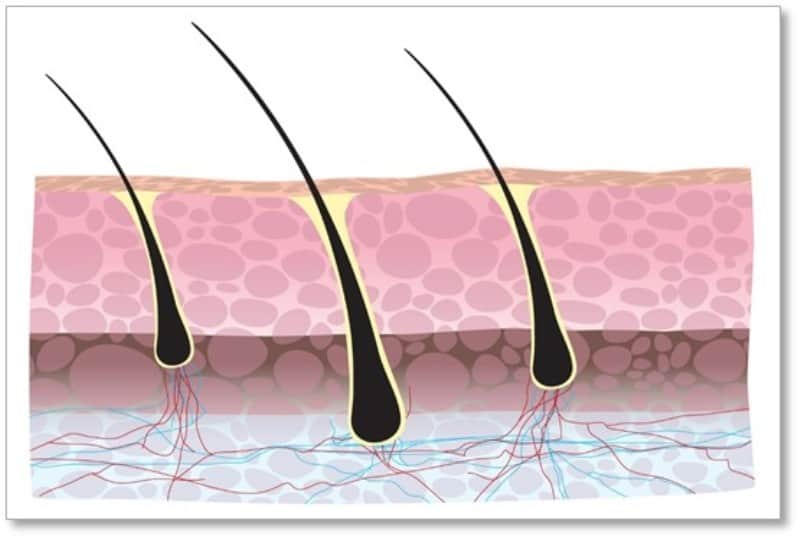 Tree folliculitis tea oil Home Remedies