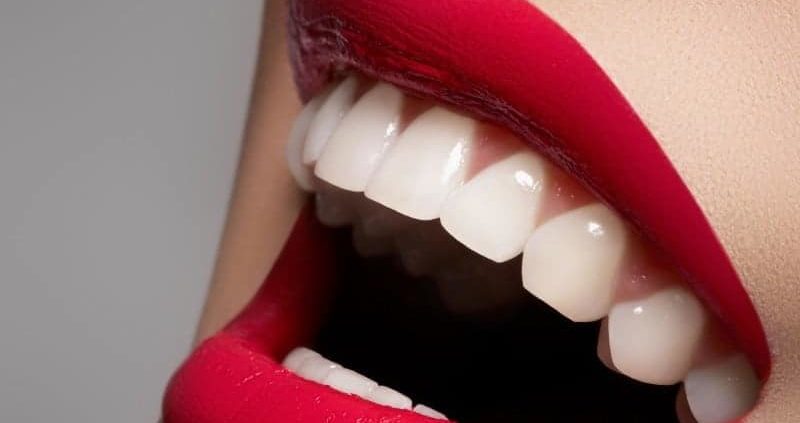 How To Get Rid Of White Spots On Teeth Fast