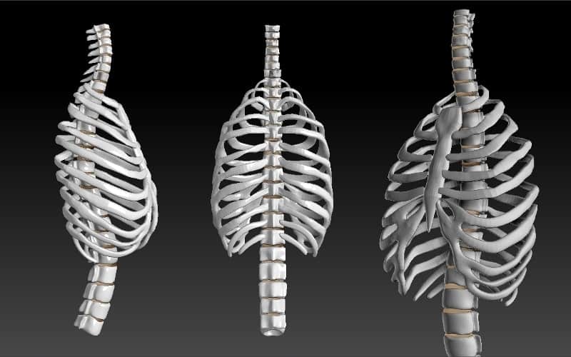 right-and-left-lateral-views-physical-examination