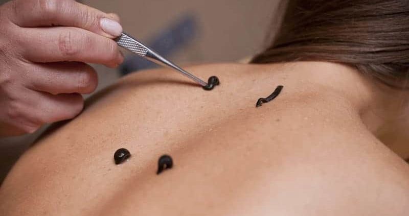 Leech Oil Health Benefits : 11 Reason Must Try For