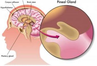 Signs And Symptoms Of The Pineal Gland Calcification