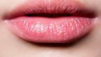 Is Diet A Reason For My Chapped Lips?
