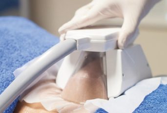 Is CoolSculpting Safe And Permanent?