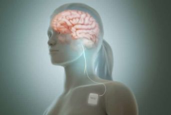 Developing A Relaxation Routine With Vagus Nerve Stimulation