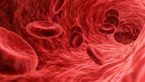 Blood Cancers: Common Types, Possible Causes, and Treatment Options